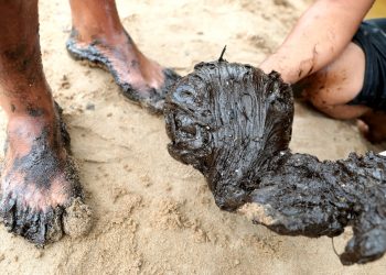Sociedade de Dermatologia divulga orientações sobre manchas de óleo