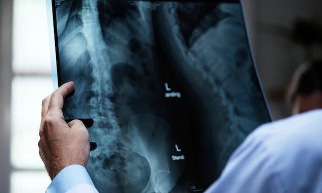 Junho Verde – de conscientização sobre a escoliose – alerta para importância da identificação e tratamento