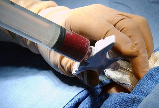 Fevereiro Laranja chama atenção para um dos tipos de câncer mais comuns no Brasil